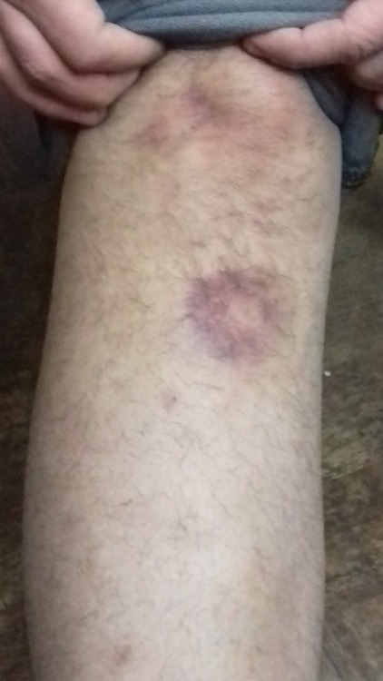 Rugby can be hard !