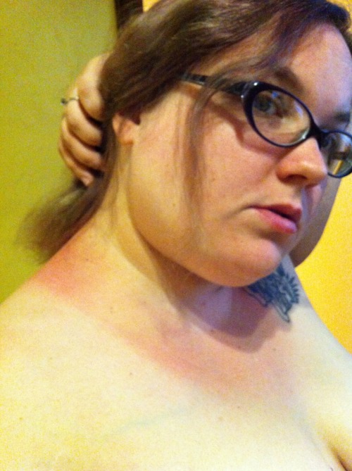 plush-dragon:  Except for the back of my neck, the sunburn is quite a bit better.