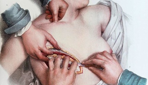 sweatermuppet:tapeworrm:THE HORRIFIC INTIMACY OF SURGERY AND DISSECTION.Wishbone - Richard Siken // 