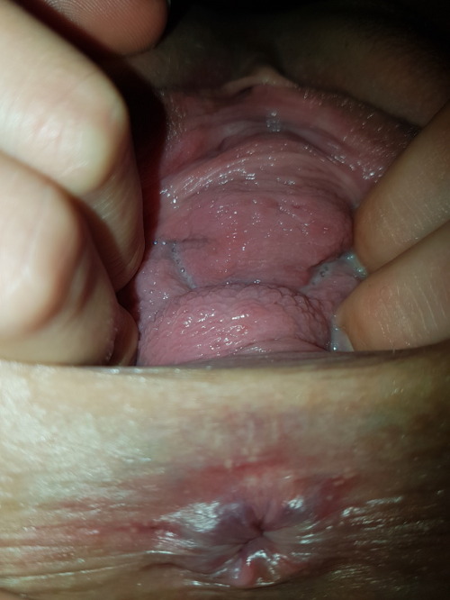 humilatedxoxo:  Gaping my bucket cunt after stretching and fisting it….. lick it bitches  @humilatedxoxo, presenting a pretty huge prolapsing vagina. Looks like a lot of fun