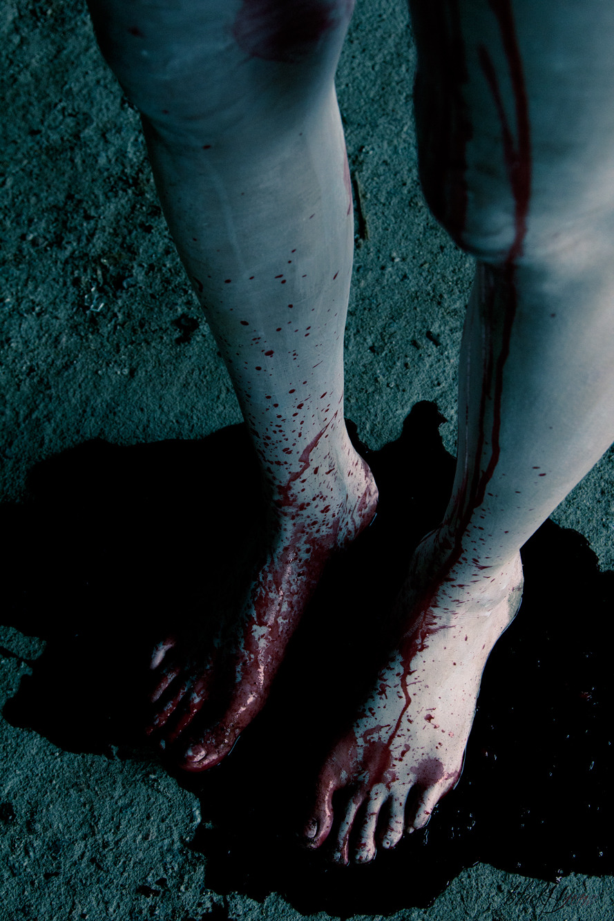 blakhyena:  one more time bleeding 