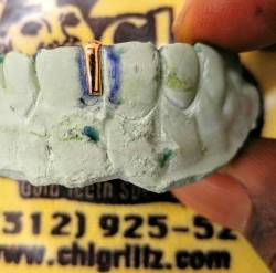 chigrillz-goldteeth:  😬 #CustomGrillz …. #Solidgold #gaptooth #gapfiller #Goldteeth #customfit  #jewels #instajewelry #instaGrillz #Grillz #Goldteeth #top and #bottom #set #classic #solid #top #slugs #swag #mouth #teeth  #removable #GRILLS by #ChiGrillz