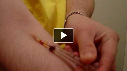 Stormtrooper4u watched Live IV Injection! on Liveplay