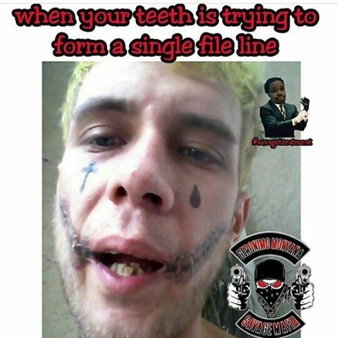 BESTIE #TEETH #FUNNYMEMes #FUNNYMEME #FUNNYpictures @geronimo_montana_10.5 #FUNNYpicture #FUNNYpictu