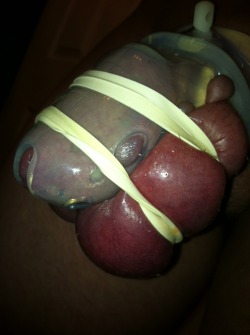 Mistressh666:  Cbtpictures:   Banded Balls. Smashed Balls And Pico Torture. So Good!