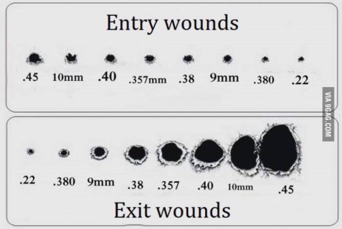 magicmedic:Trauma guide to gunshot wounds