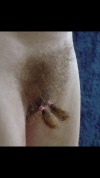 hairy-hillbilly: