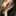suddenlyskin: