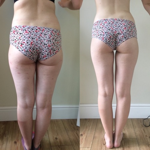 aro-ana: hungry4starving: 50 days of weight loss (day 50 was September 2nd so I need to post a new b