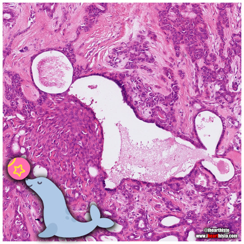 Seal Syringoma This is definitely the sealiest thing I have observed in a histology slidei❤️histoA s