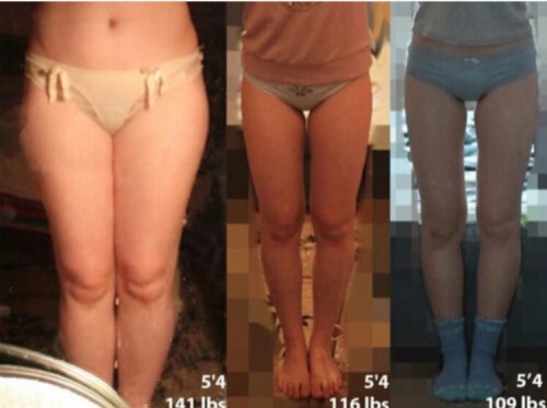 xskinnymilkx:  guns-inmy-head:  desireforskinny:  Favorite thinspo: before and after edition  I love this 