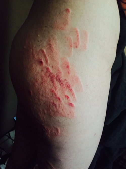 baabycunt2:  another-nail-in-my-coffin:  aliglaz:  bruisedmmmmuse:  sick-young-man:  This girl got play time with daddy today. For every 10 swats of the cane she took without squirming or running away she received a mark to remind her. I’m so proud