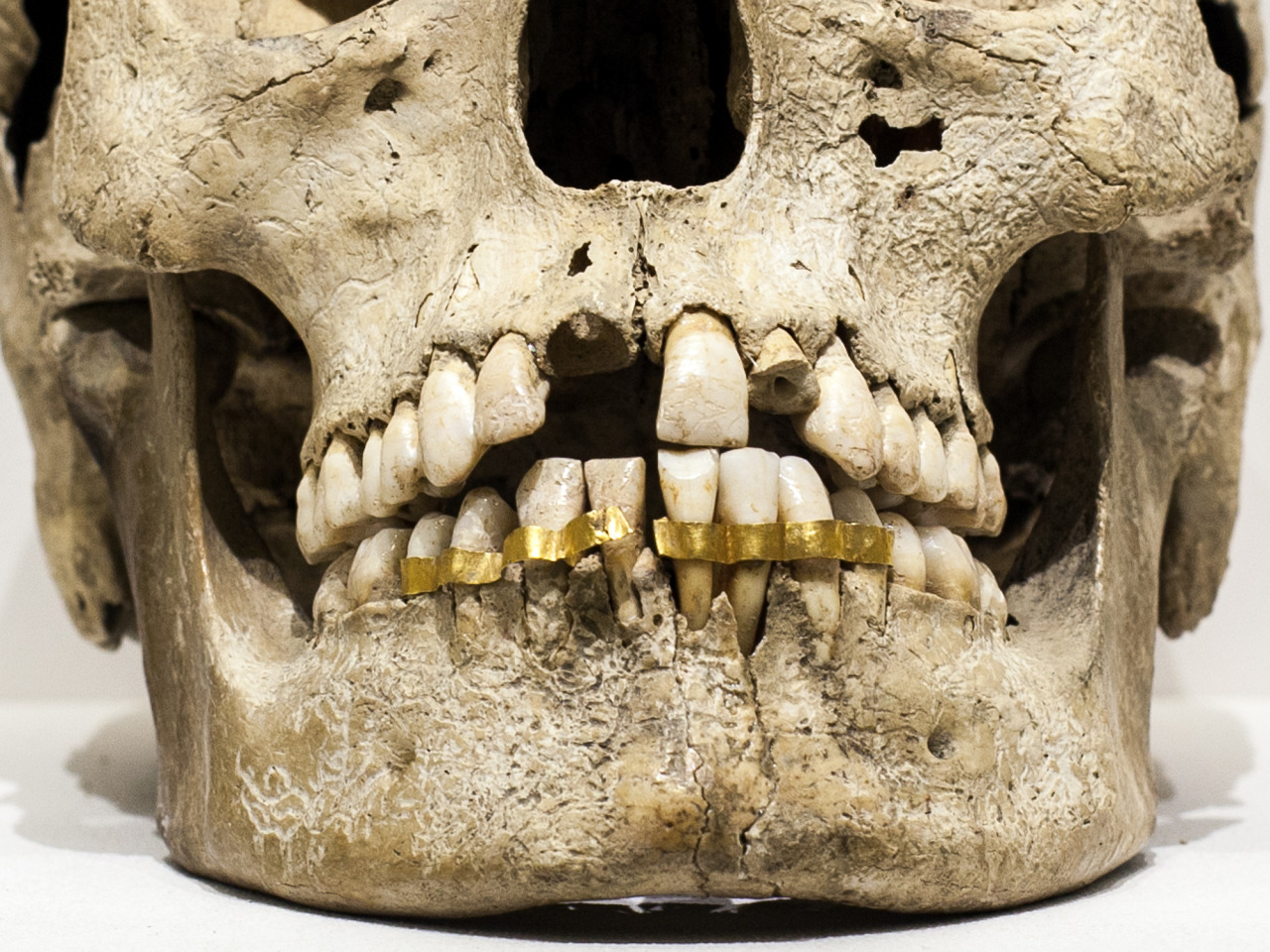 museum-of-artifacts:    Going to the dentist today is (almost) like spending the