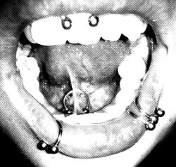 aborto-de-satanas:  I miss my piercings. :( 