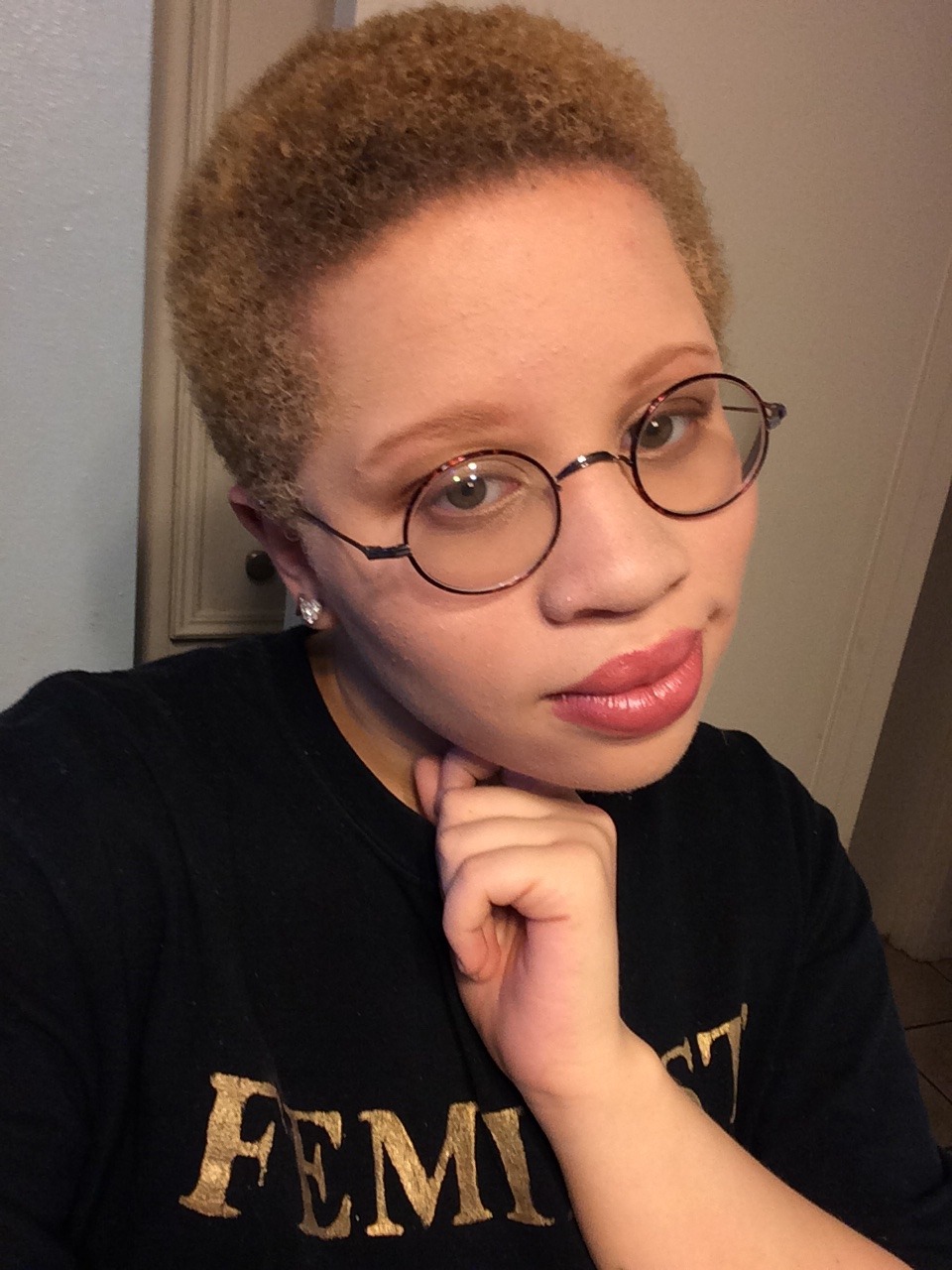 succboi-tony:Always been too scared to post for this… Albinos represent!! ✊🏻