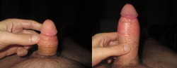 circdguy:  Whether it’s soft or hard, the circumcised cock has the same pleasing appearance. The bare cock head always remains on full display, as does the distinctive shaft scar.  Perfect