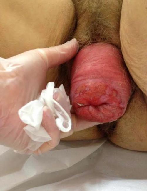 prolapsingpussy:  Full Prolapse  Happy to get your pics, just submit via the funtion on top of my blog  I think this is the most total prolapse pic I’ve ever seen. True 100% inside out pussy tube in the guys hand. Just a big meat sock. I wonder