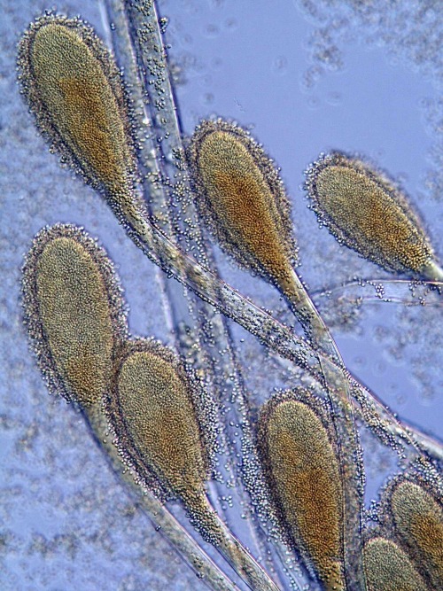 drrestless:The Hidden Life of Microscopic Fungi