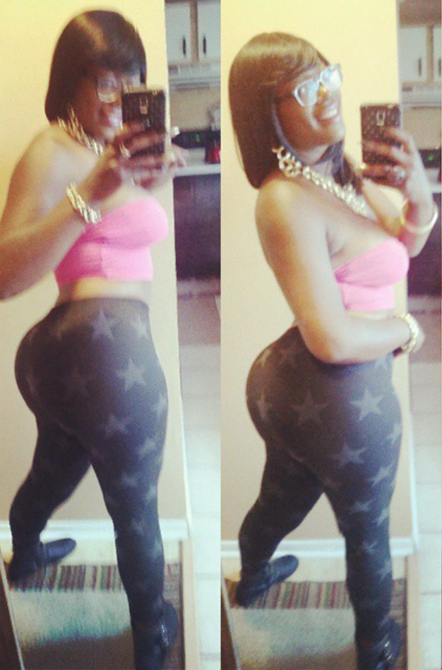 R.T.E.®