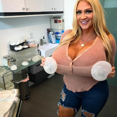 faketitslover999:fakerbetterforever:Look how dumb and ridiculous she looks with those huge fake tits