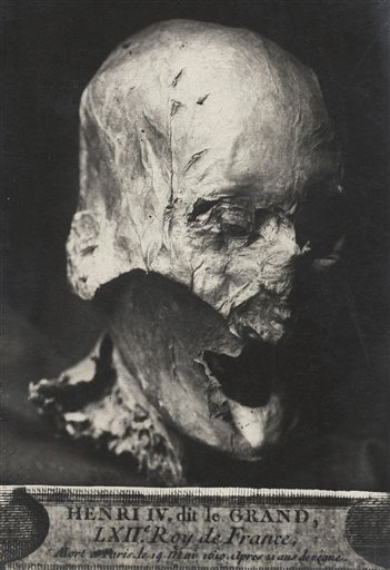 Creepy: King Henry IV’s partially preserved head, which was separated from its