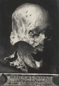 Creepy: King Henry IV’s partially preserved head, which was