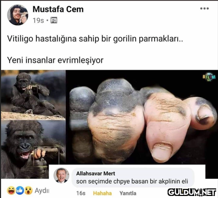 Mustafa Cem 19s. Vitiligo...