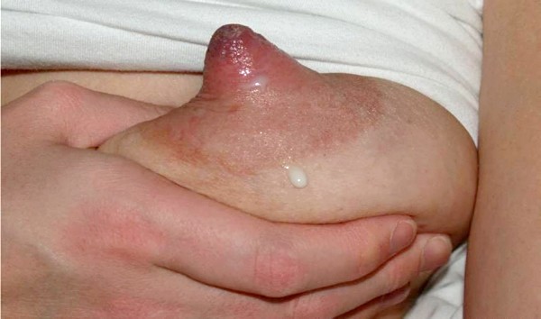 All nipples