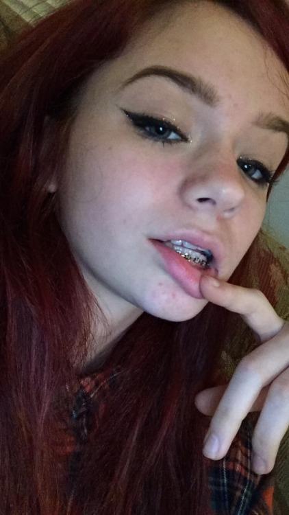 metalperks: the grillz r strong wit dis 1