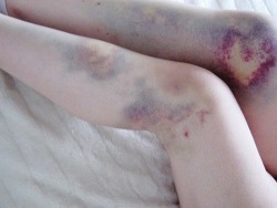xxx tumblr