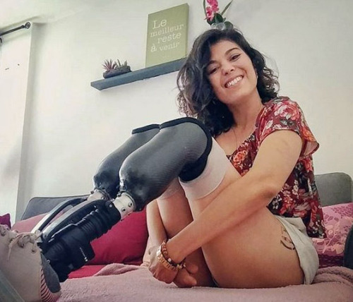 phelddagrif:French DBK and finger amp smiling with her nubs in prosthetic legs