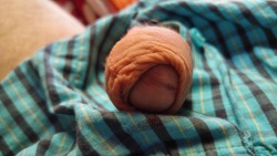 foreskinlovecircumfetish:  User submission, velvety foreskin   Circumcision required