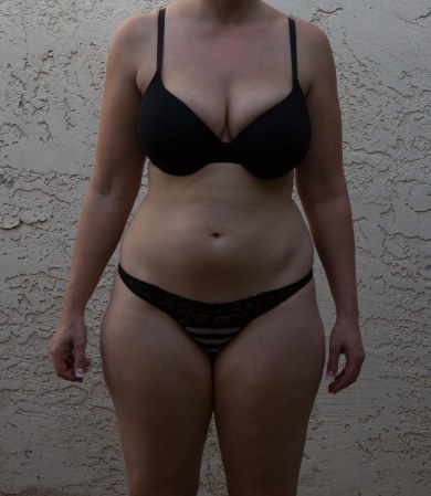 celluloisseur:  This woman is under the misguided impression that her cellulite is