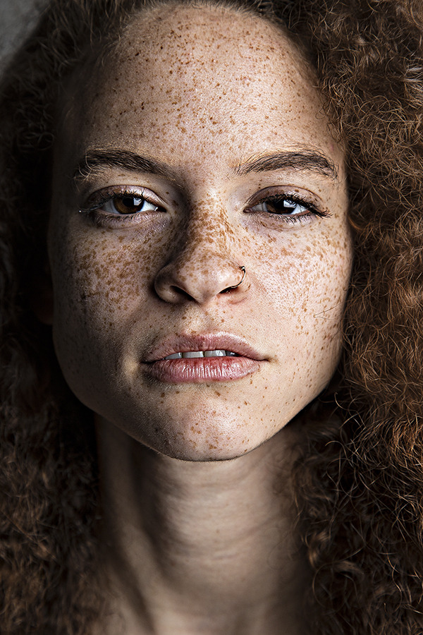 who doesn't like freckles?