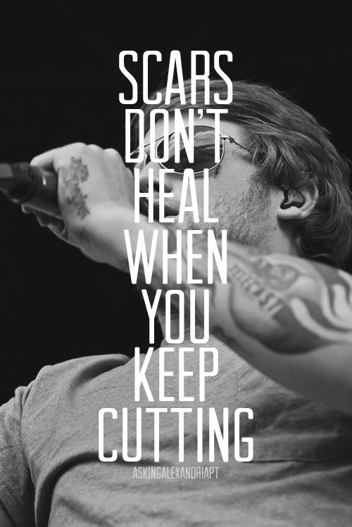  Asking Alexandria  
