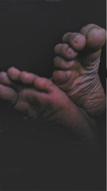 g-feet20:  An old set of photos I took with a webcam a while back. Sorry about the