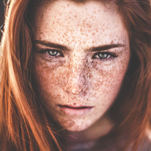 XXX furrycollectionperson-things:Freckle face photo