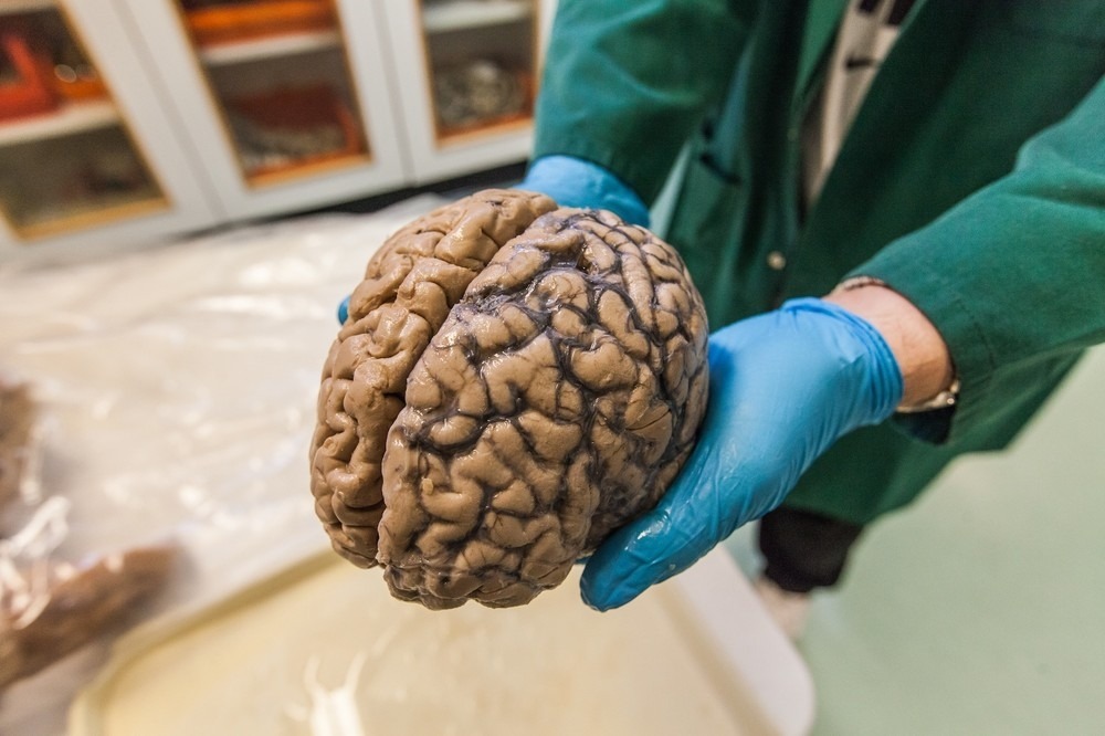 flyonthewallmedstudent:  forensicimagination:  (via What Happens When You Donate