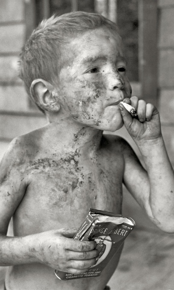 Leatherwood, Kentucky, 1964. Boy Covered By Dirt Smoking Cigarette With One Hand, Holding Can Of Tobacco