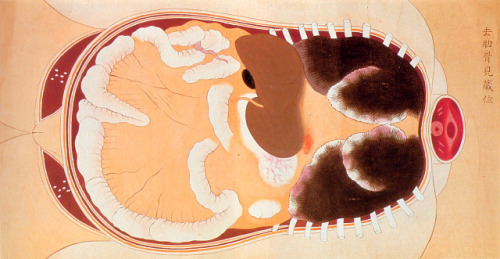 Female dissection. Edo-Period Japan.Conducted on the body of a 34-year-old female executed criminal.