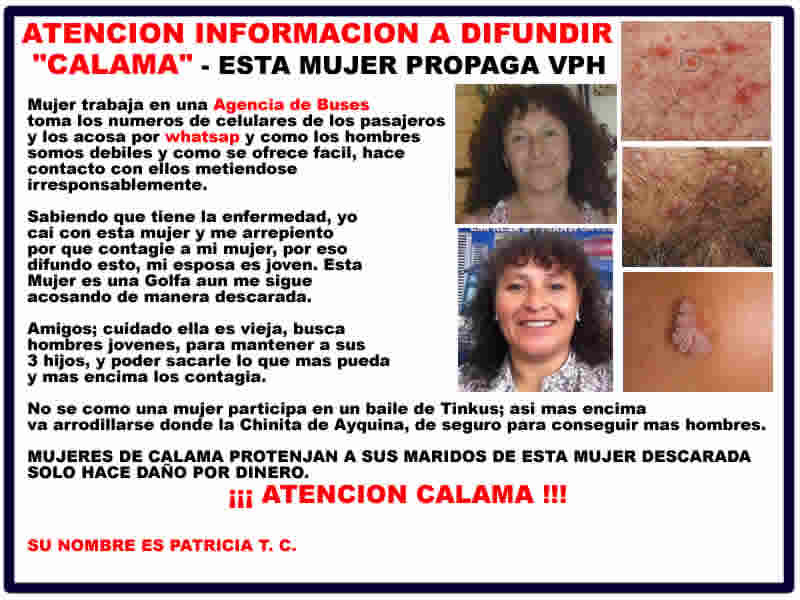 noticiasdeldesierto:  DICEN QUE ESTA ENFERMEDAD ES PEOR QUE EL VIH, YA QUE TE MATA