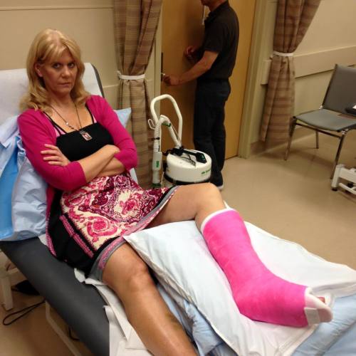 Despite the nice fresh cast on her broken ankle this blonde looks rather unhappy.