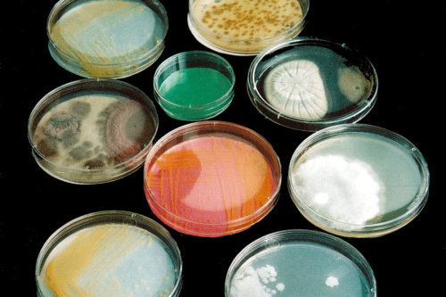 vuls:An array of Petri dishes with bacteria and molds cultured from the Japanese oyster (Crassostrea
