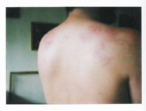 My back after the visit of Eric Laos Salazar Instant photography 8.5 x 10.5 cm
