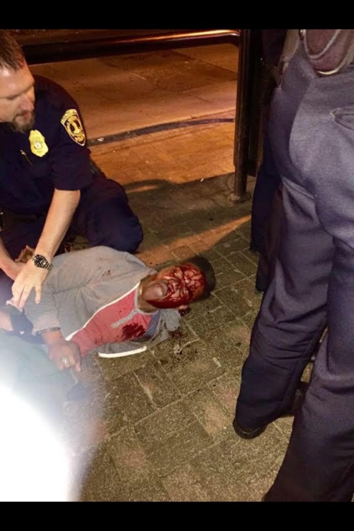 kpierreart:futuremrsknow-it-all:dfresilient:#blacklivesmatter #uva #policebrutalityI just wanna throw this out there: apparently Martese doesn’t even HAVE a fake IDNot that that matters. Regardless, this young man DID not deserve this treatment.  This