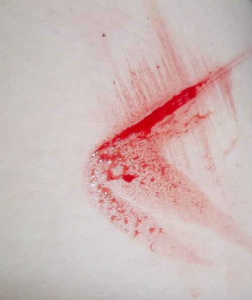 bruised-porcelain:  ✧*:･ﾟ㉨Pale&Frail㉨･ﾟ:*✧ 