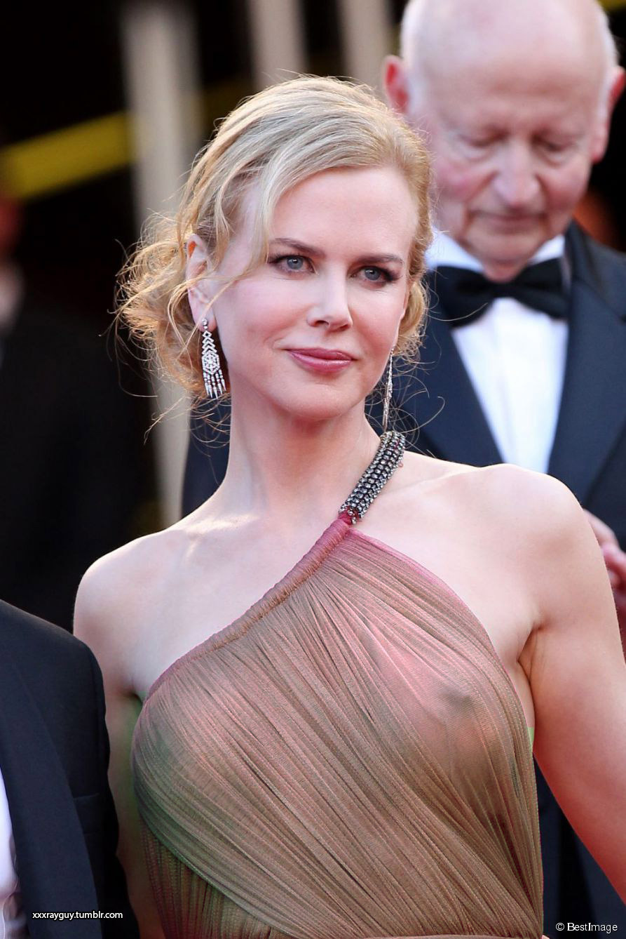 xxxrayguy:  Nicole Kidman request complete I can xray your pics privately. Click