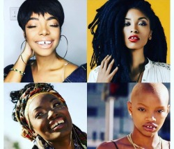 afrodesiacworldwide:  Love ❤️ yours”Diastema”