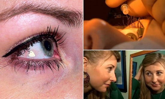 Woman Gets Platinum Jewel Implanted in Her Eye to Make Herself Unique
http://www.odditycentral.com/news/woman-gets-platinum-jewel-implanted-in-her-eye-to-make-herself-unique.html
“ ”