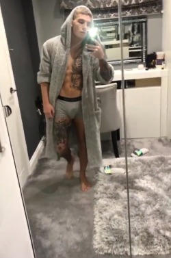 malecelebunderwear:  Brandon got a new leg